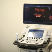 پیشرفته ترین دستگاه اکوی قلب جنین